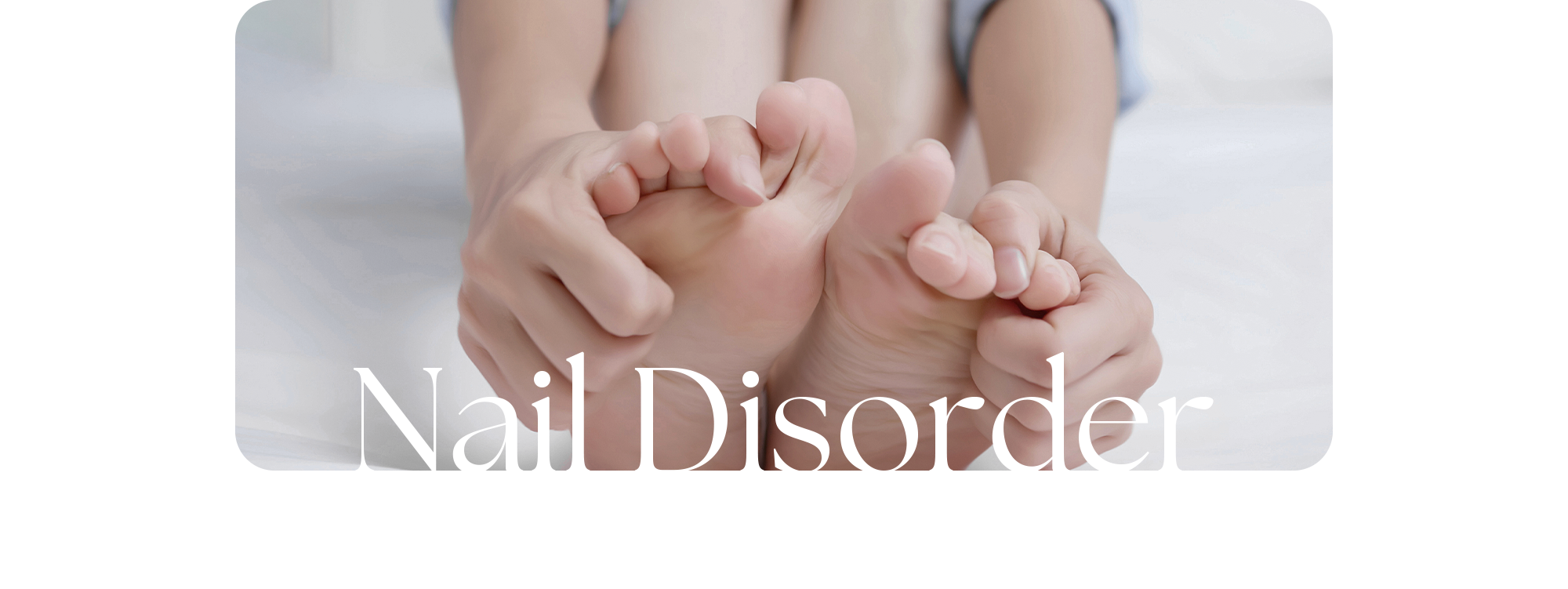 외상이나 신발 압박 등으로 변형된 문제성 발톱 Nail Disorder