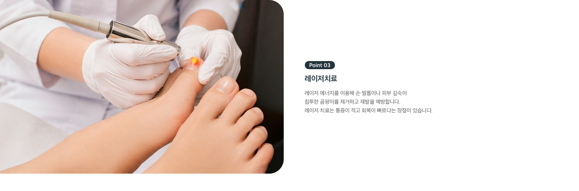 Point 03 - 문제성 발톱 레이저치료, 발톱과 피부 깊숙이 침투한 곰팡이 제거와 재발 예방