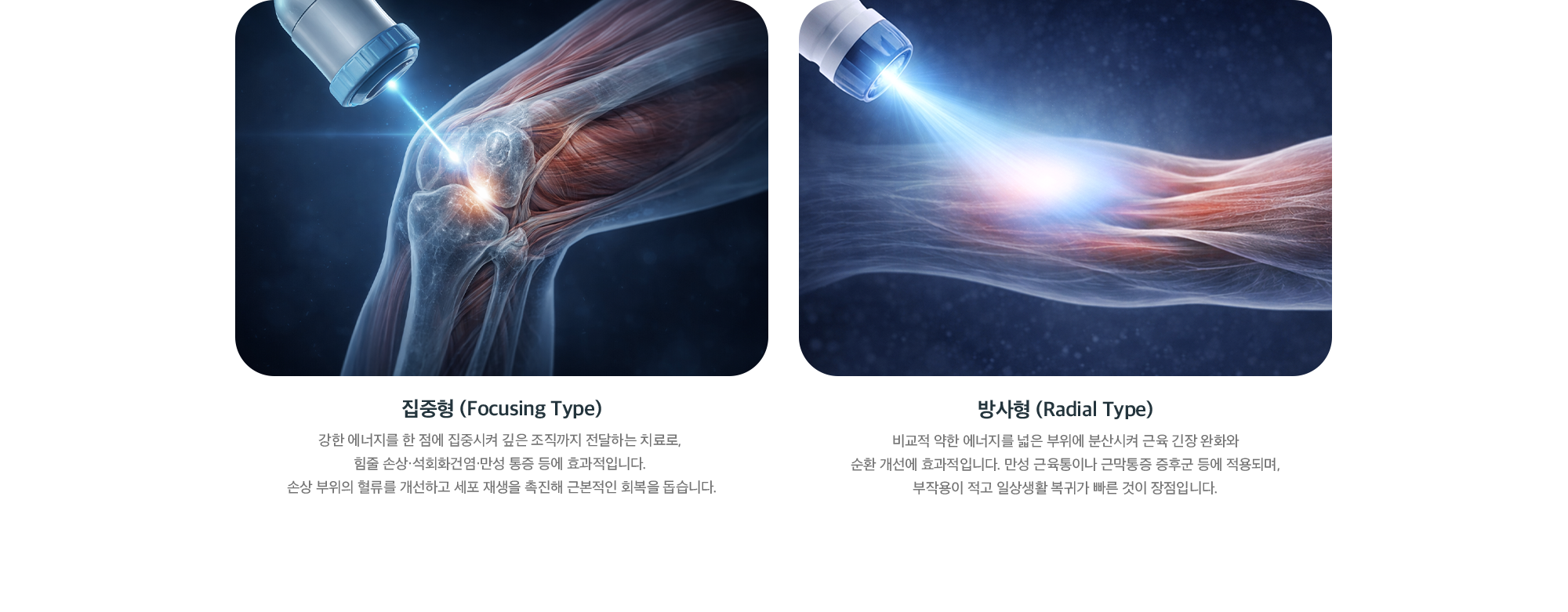 체외충격파 종류 - 집중형(Focusing Type)은 깊은 조직 만성 통증, 방사형(Radial Type)은 넓은 부위 근육 긴장 완화