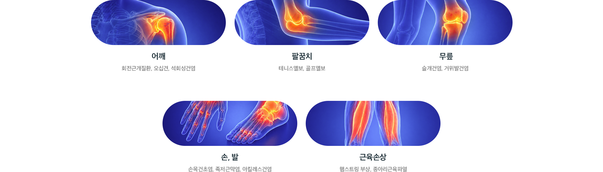 체외충격파 치료 적용 부위별 질환 - 어깨, 팔꿈치, 무릎, 손·발, 근육손상