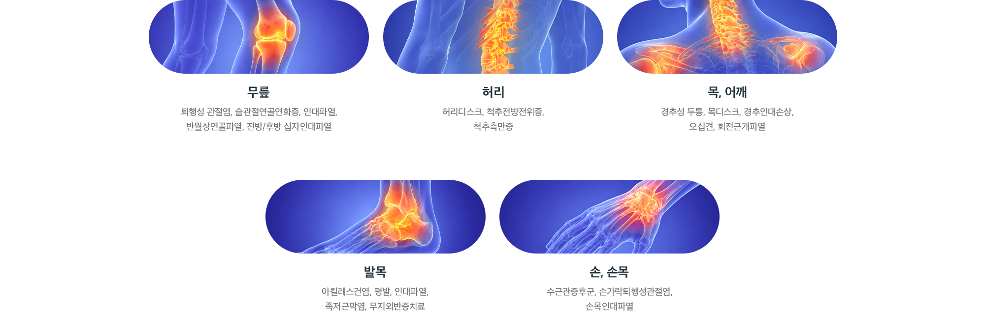 고강도레이저 치료 적용 부위별 질환 - 무릎, 허리, 목·어깨, 발목, 손·손목