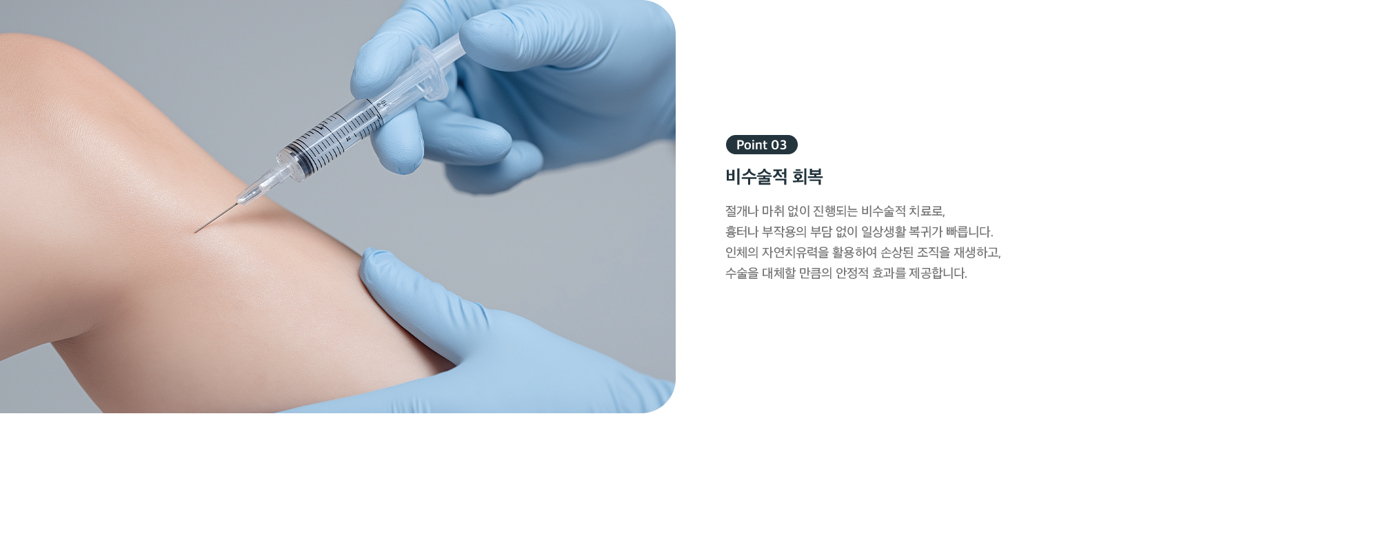 Point 03 비수술적 회복 - 절개나 마취 없이 진행해 흉터·부작용 부담 없이 빠른 일상 복귀