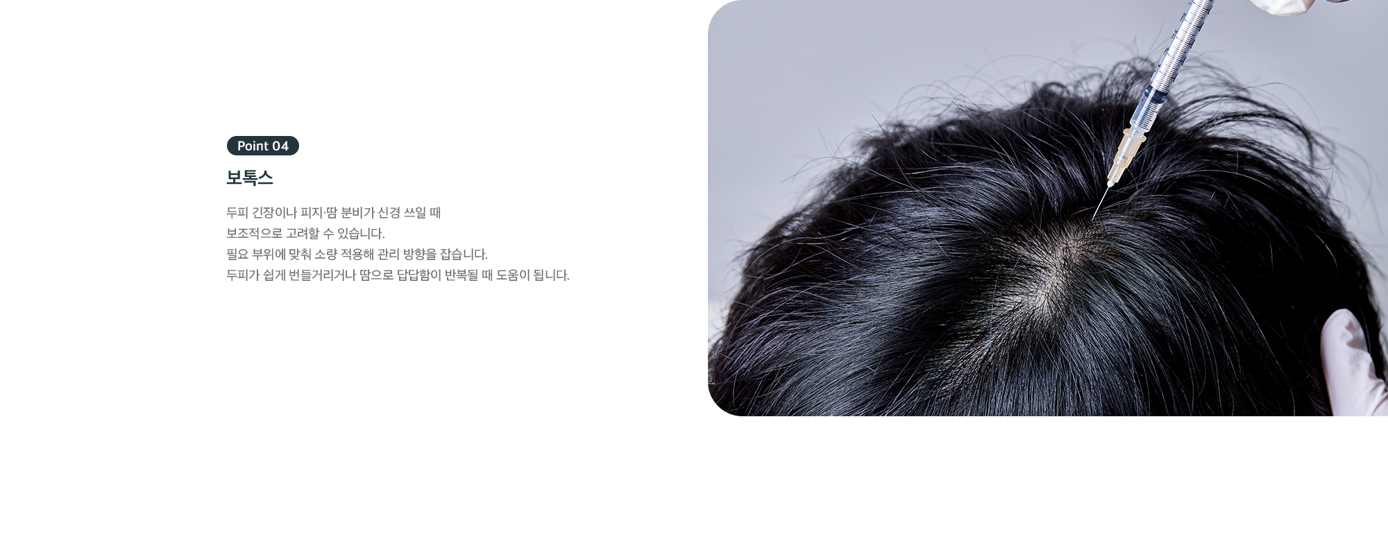 Point 04 - 보톡스, 두피 긴장이나 피지·땀 분비 관리를 위한 보조 적용