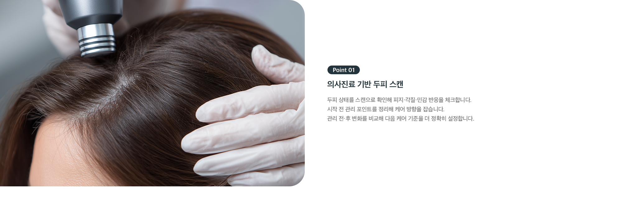 Point 01 의사진료 기반 두피 스캔 - 피지·각질·민감 반응 체크로 케어 방향 설정