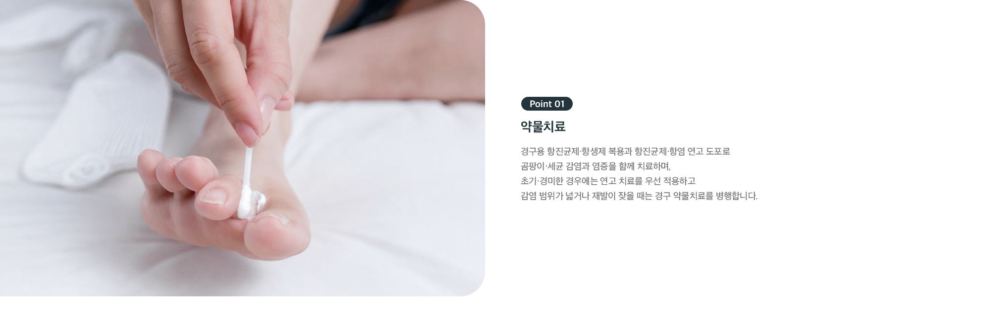 Point 01 약물치료 - 항진균제, 항생제, 연고로 곰팡이와 염증 치료