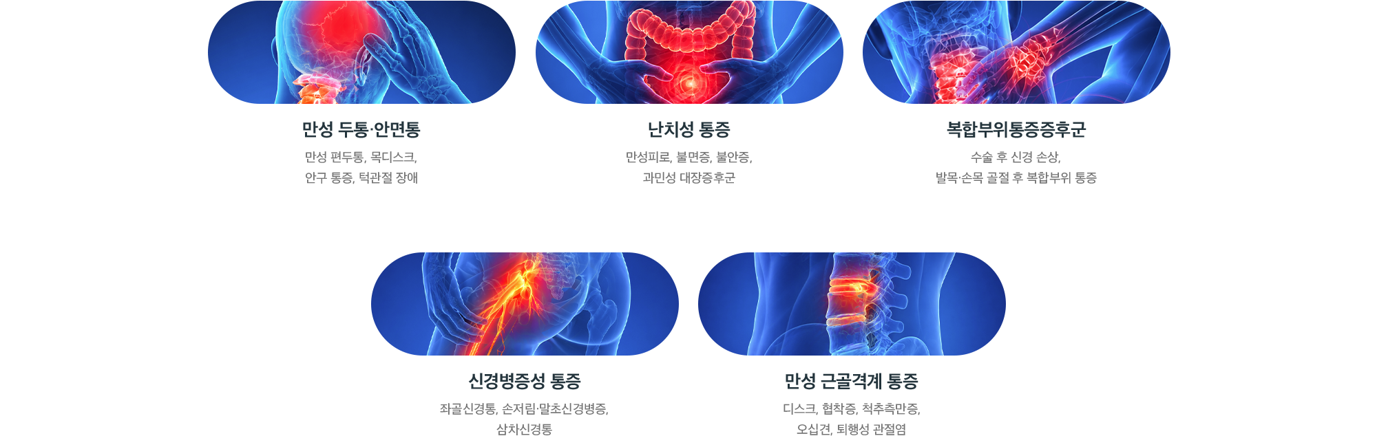 자율신경치료(SNEPI) 치료 가능 질환 - 만성 두통·안면통, 난치성 통증, 복합부위통증증후군, 신경병증성 통증, 만성 근골격계 통증