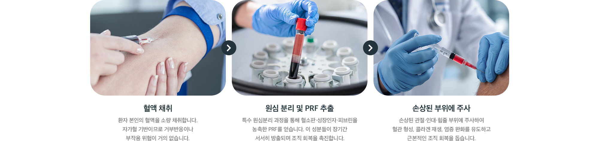 PRF 주사 단계 - 혈액 채취, 원심 분리 및 PRF 추출, 손상된 부위에 주사
